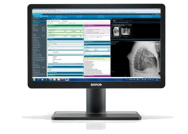 Monitor de grado médico Barco Eonis 22" MDRC-2422 negro, de frente